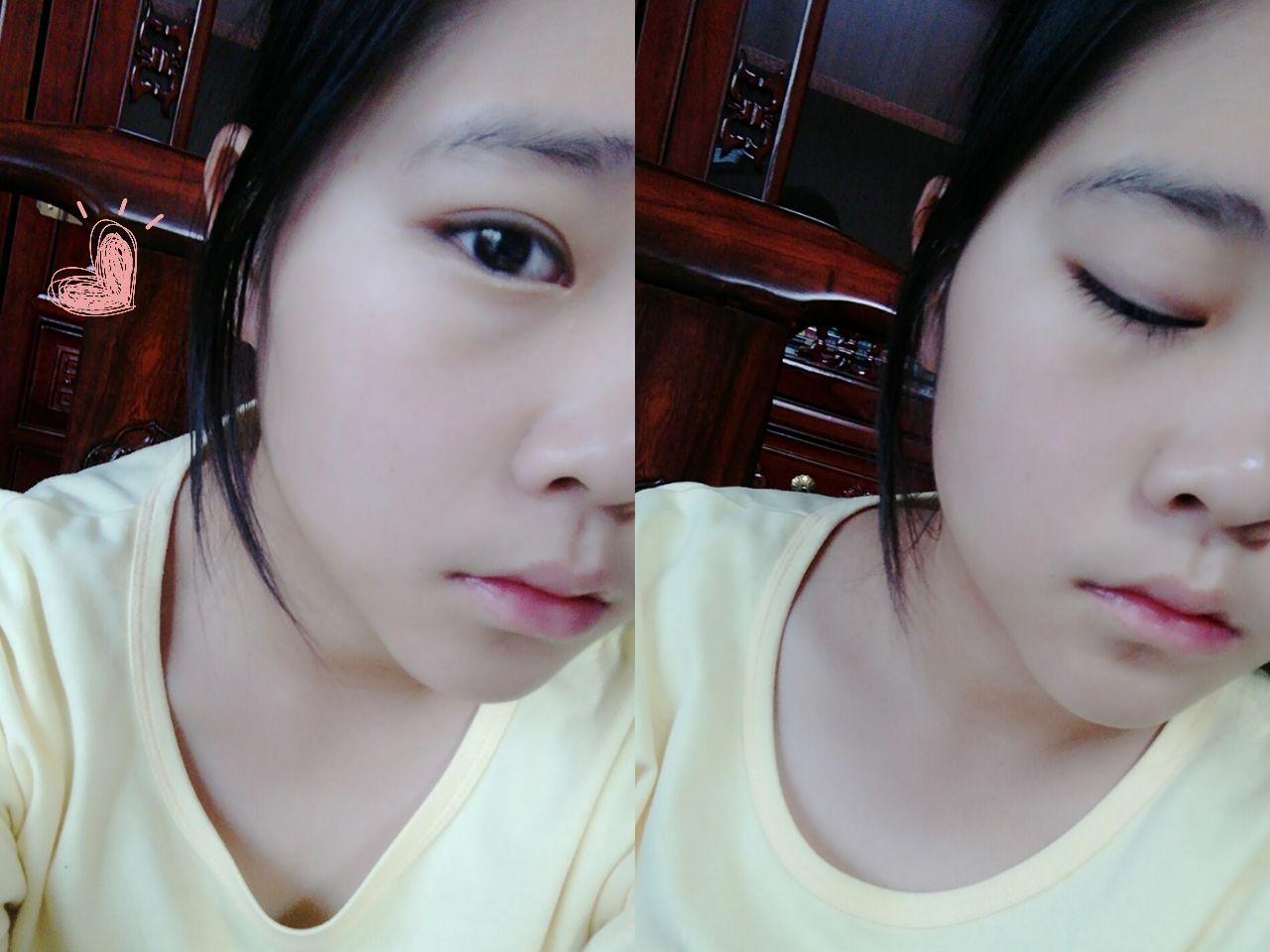 一只眼睛好看一只眼睛不好看是一种什么样的体