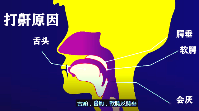 睡枕里的黑科技呼噜娃的小天敌