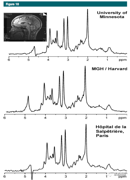 radiology:质子磁共振波谱分析在中枢神经系统疾病中的应用