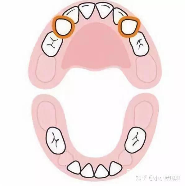 寶寶什麼時間出牙算正常長牙難受怎麼辦