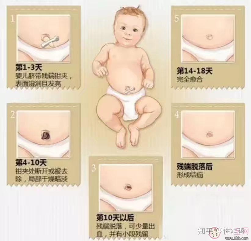 在小宝宝出生之后,脐带上面的血管,只是一个功能上的闭合,实际上它