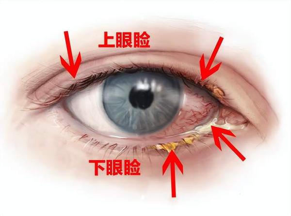 你给眼睛洗过澡吗？ - 知乎