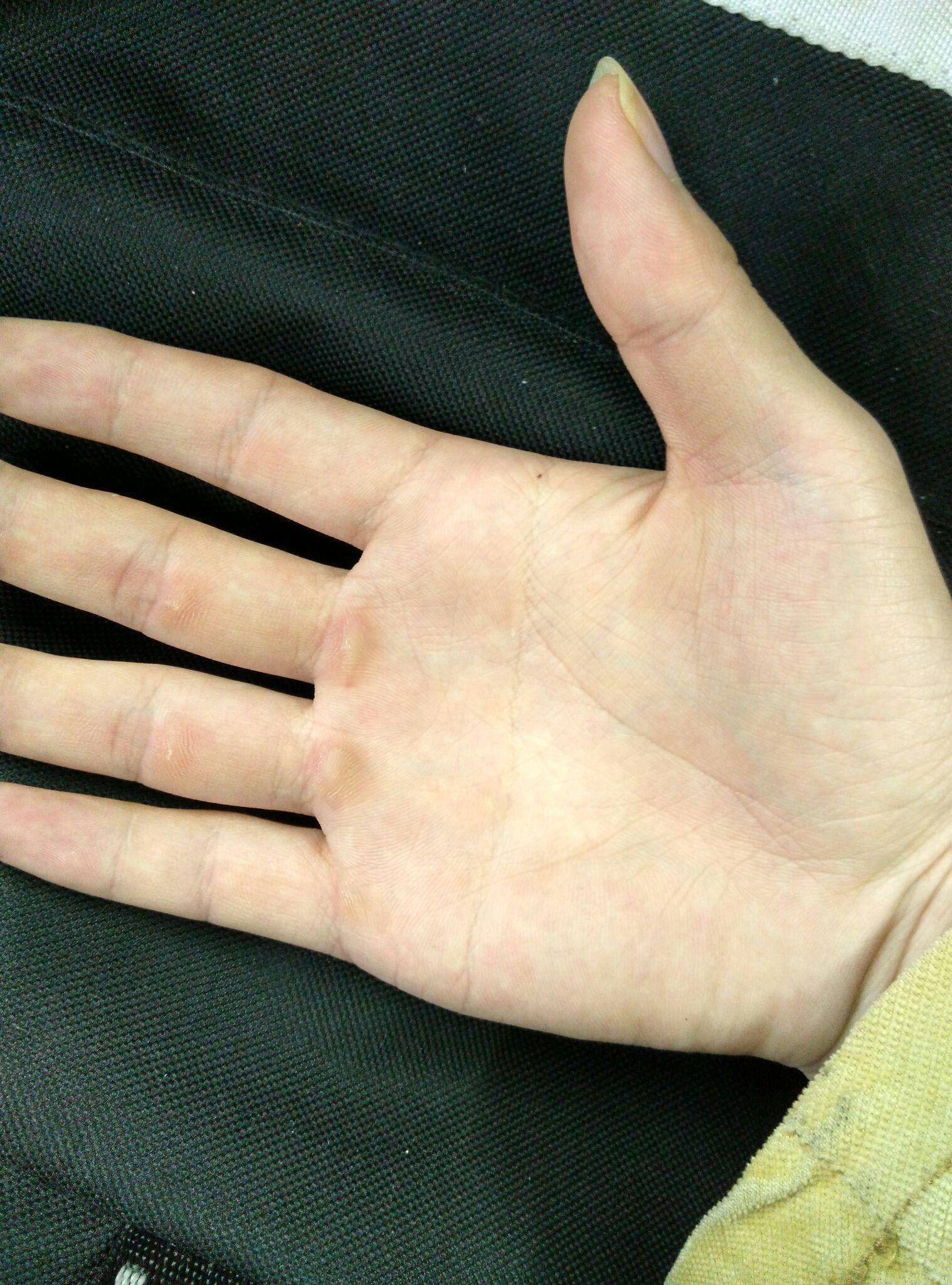 作为一只资深单身狗手上有老茧意味着什么