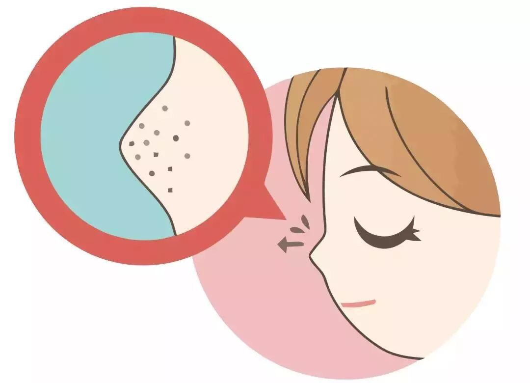 请问甲硝唑凝胶去黑头能行吗?想看专业人士的回答? - 知乎