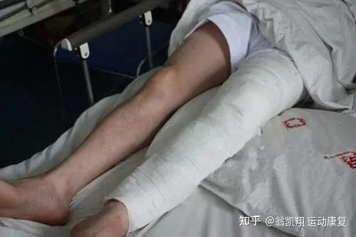 髌骨骨折术后如何系统康复训练