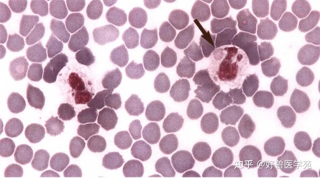 红细胞呈深蓝灰色,这就是无法识别多染色性红细胞.