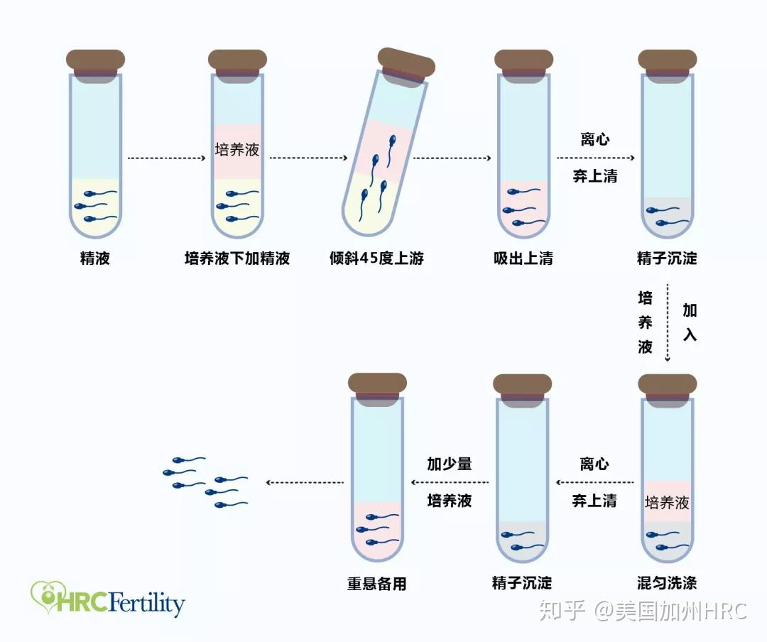 03  perecoll非连续密度梯度离心法第三种方法就要更加复杂一些.