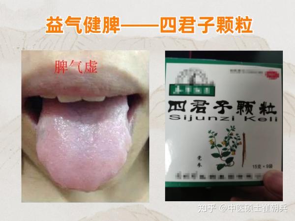 史上最全8种健脾祛湿中成药！学会全家受益 - 知乎