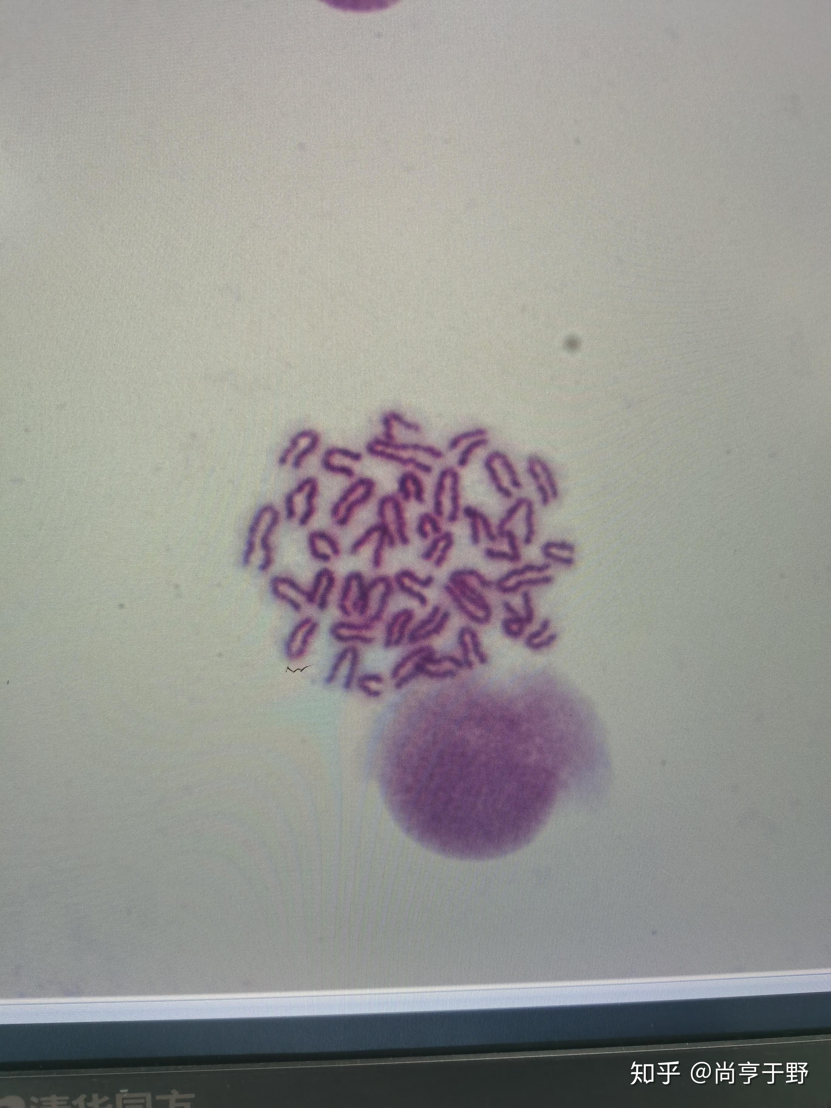 小鼠染色体的形态特征是什么