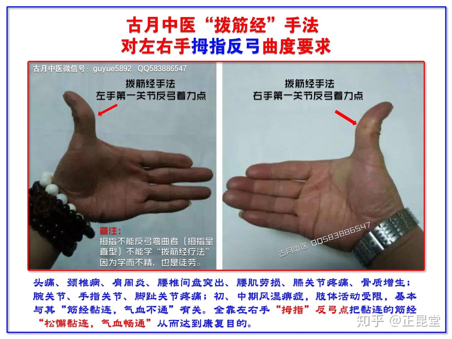 古月中医“拨筋经”非药物疗法正昆堂解析 - 知乎
