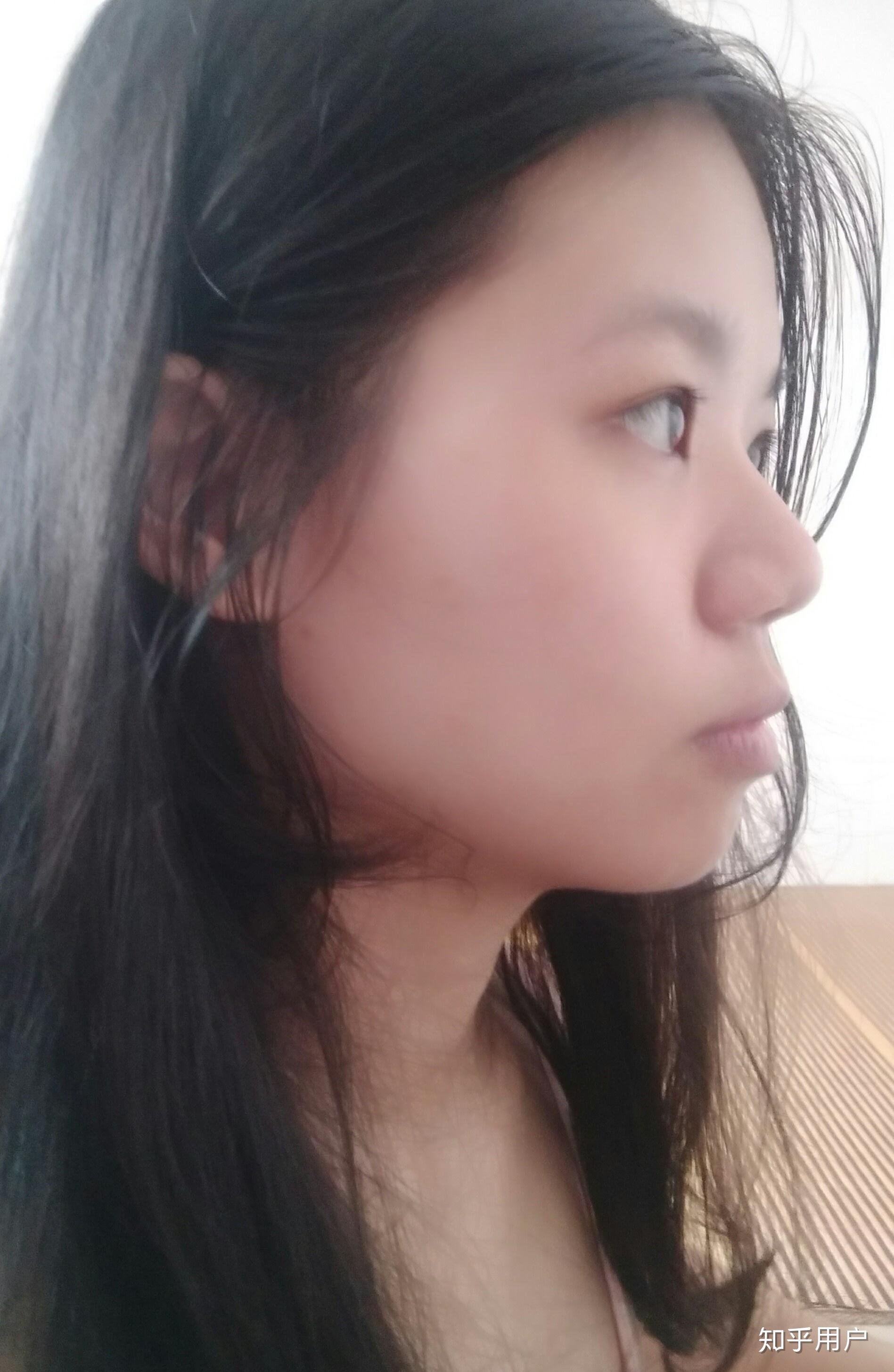 侧脸丑而正脸好看是一种什么体验