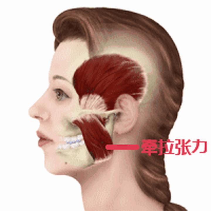 深8颧骨颧弓内推的后遗症看看能接受再决定吧