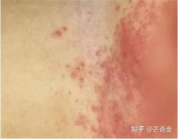皮肤在各年龄段,容易出现什么问题? - 知乎