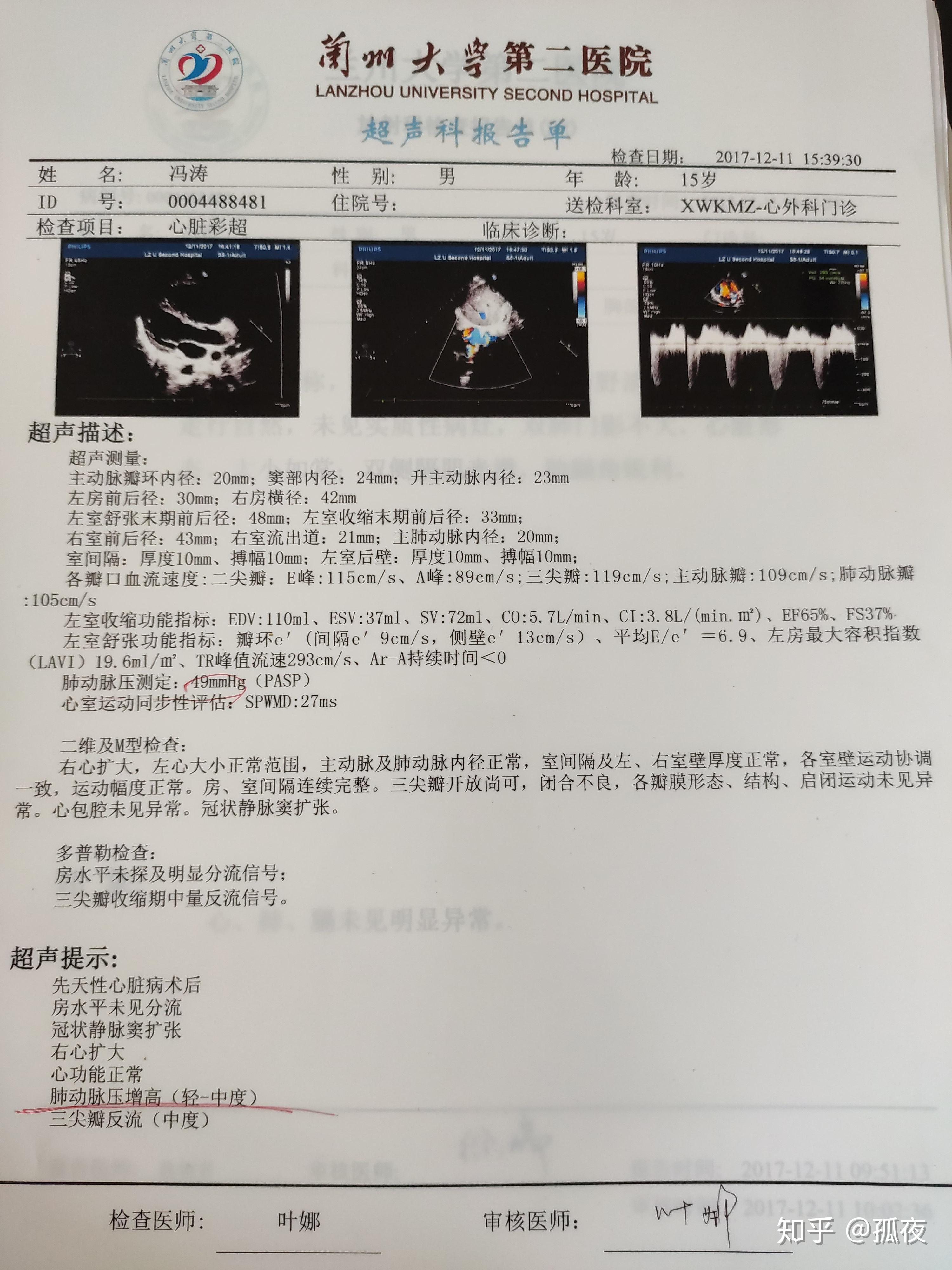 二尖瓣狭窄超声报告图片