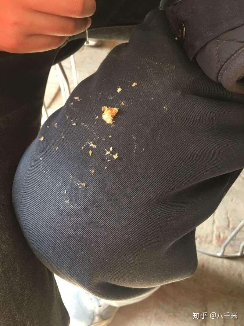 耳屎最大能有多大