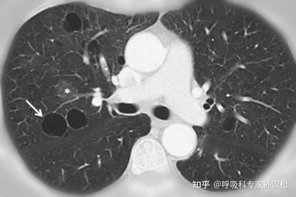 震惊 某小伙运动着 胸被气炸了 这到底是怎么回事 知乎