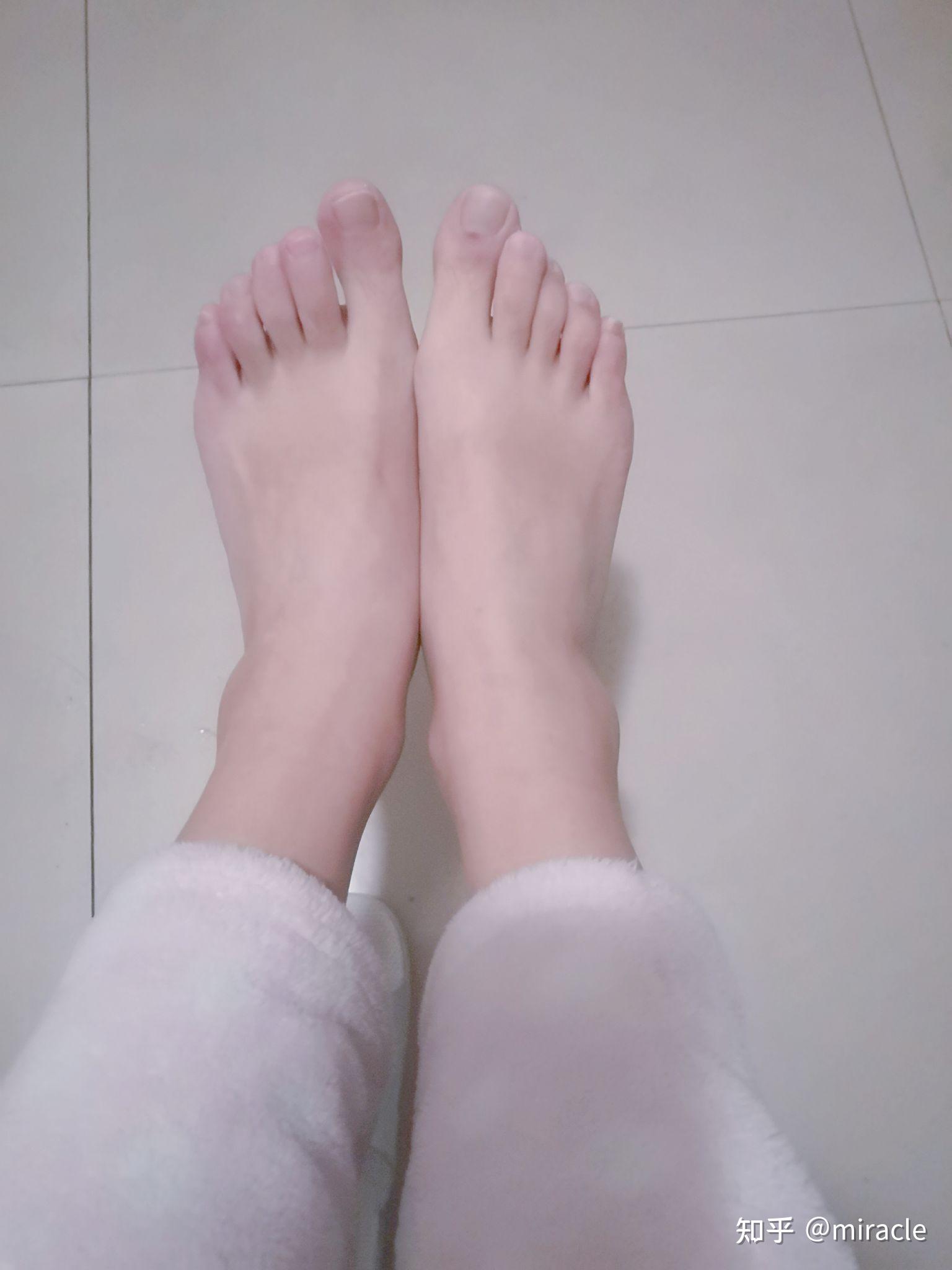 为什么很多人大脚趾短于的其他脚趾?