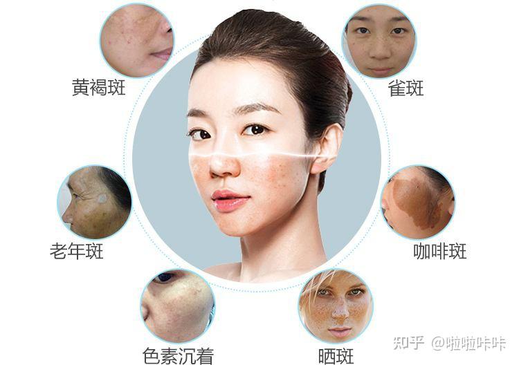 一,色斑形成原因
