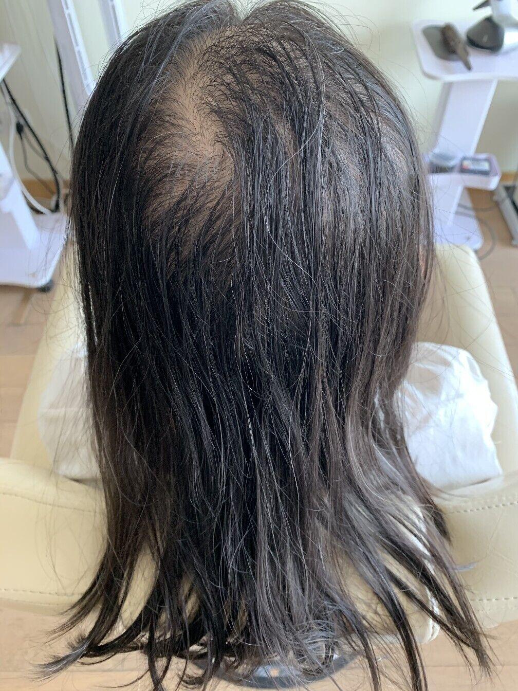 如何使自己的头发变得浓密