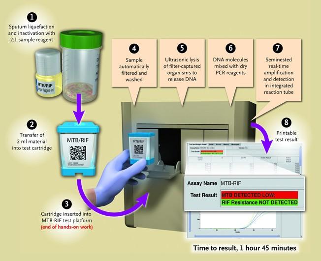 Cepheid公司的GeneXpert芯片检测流程 知乎