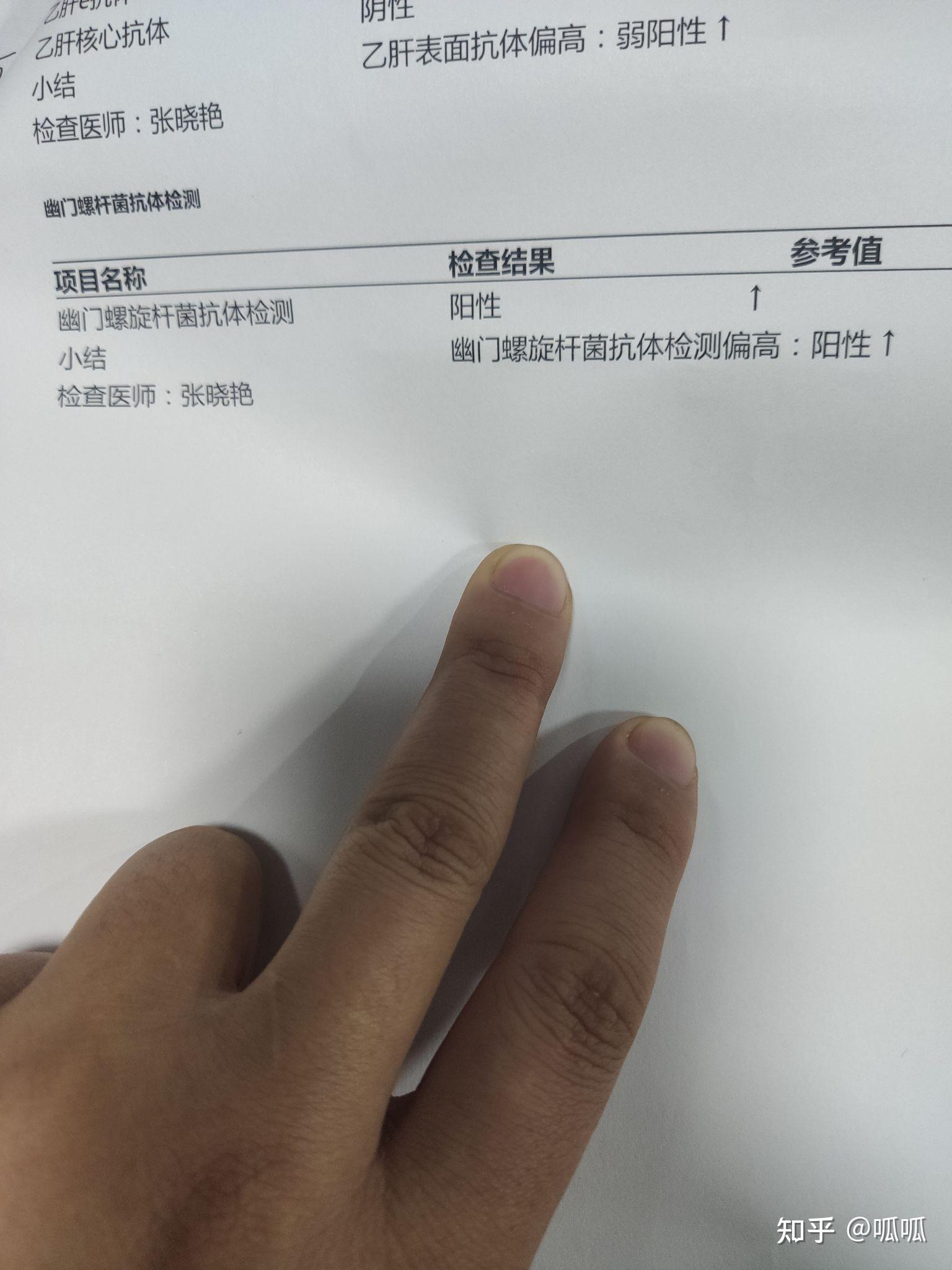 幽门螺旋杆菌这样治疗!(有图有真相)