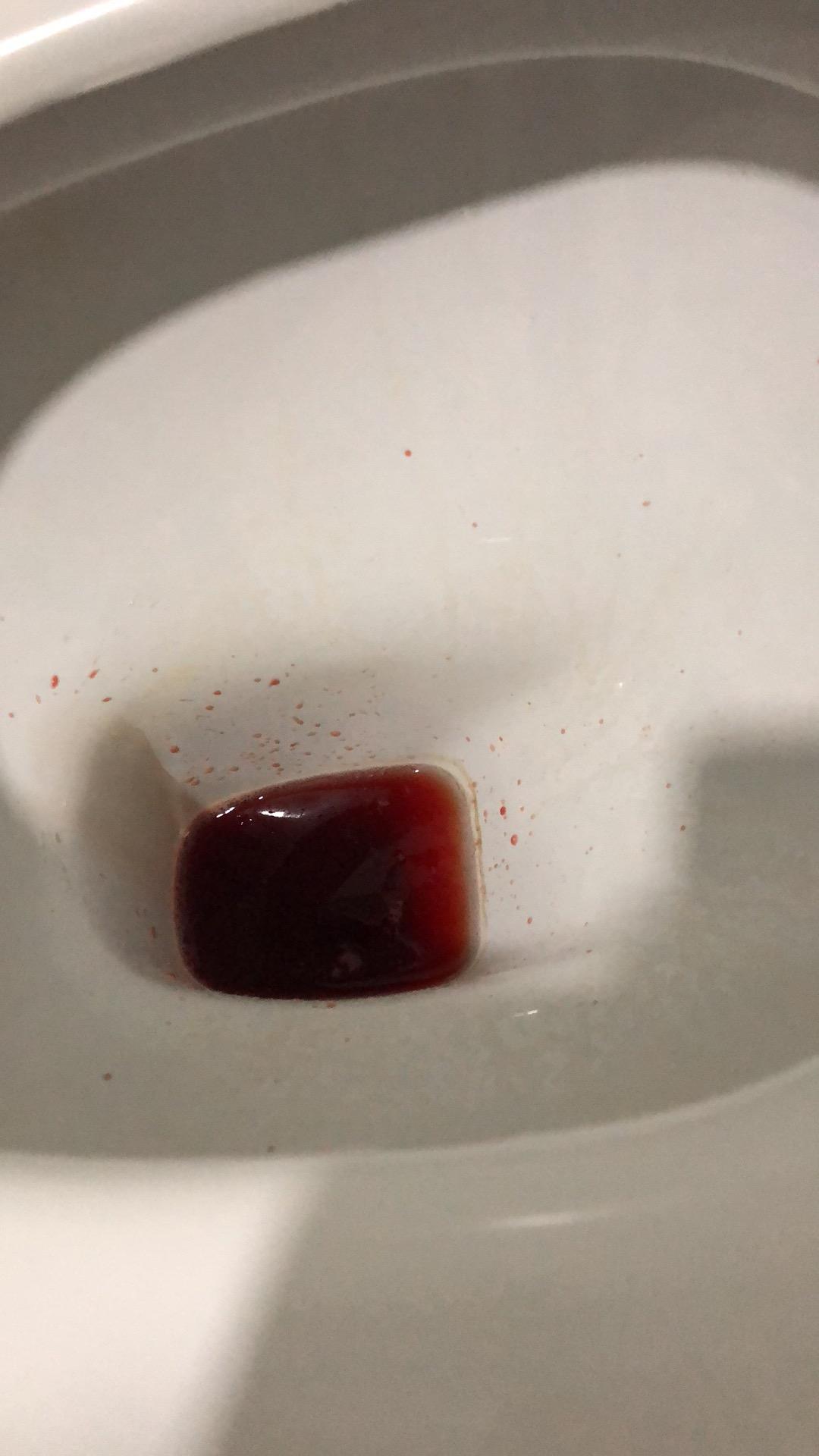 和男朋友啪啪啪之后,第三天早上起床尿尿出血,感觉尿不尽,有一点点