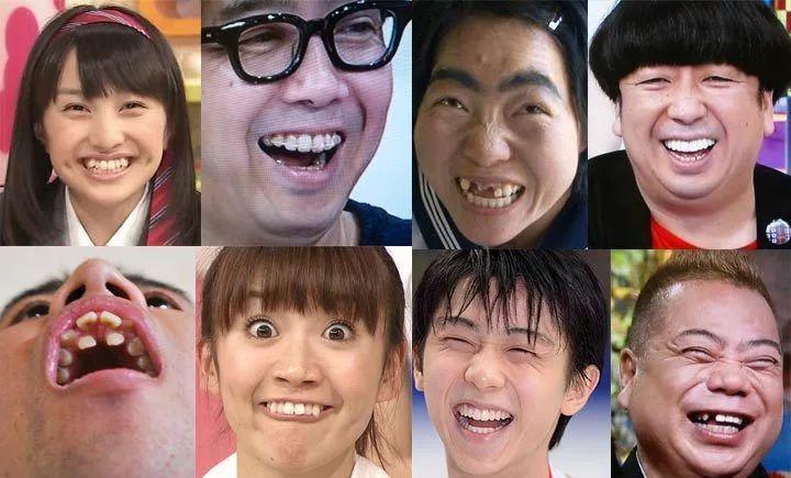 为什么日本人的牙齿这么丑 知乎