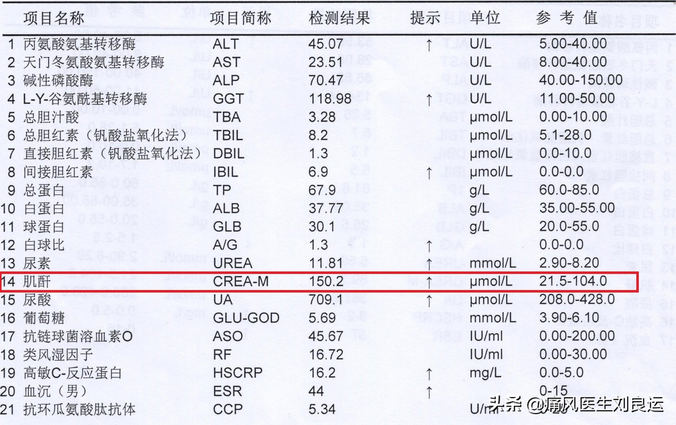 肌酐真與肌肉代謝有關,腎功能檢查少不了肌酐檢測