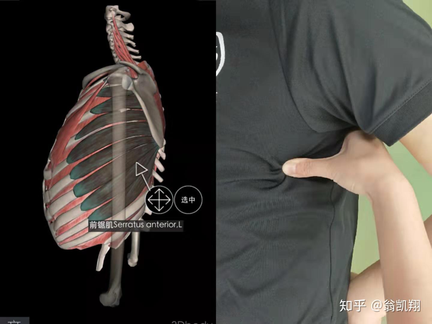 肩胛骨回缩受限?很多年了有办法矫正吗?如何矫正?