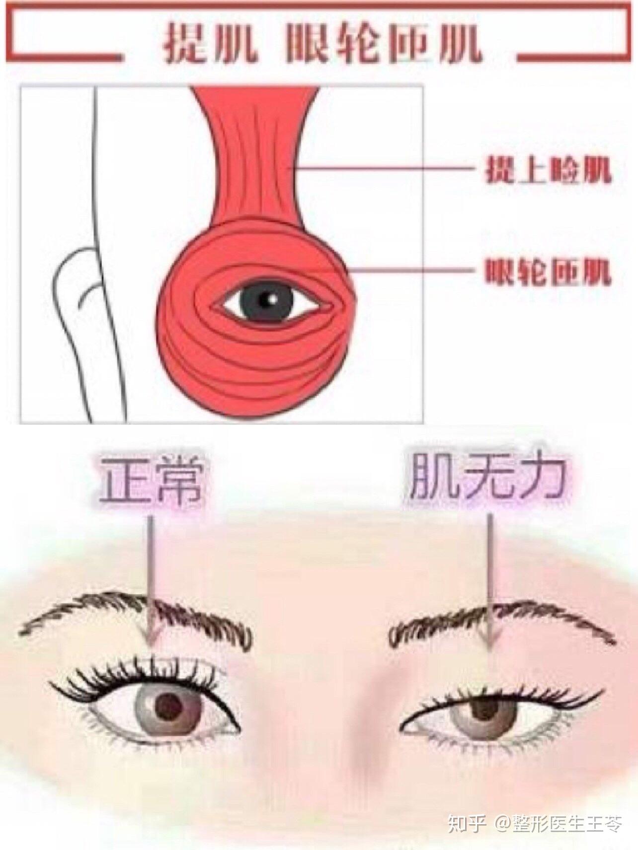 眼部无神老态提眉or提肌