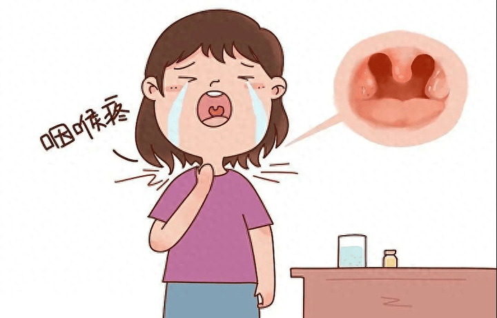 小儿急性喉炎的症状表现及病情分级 - 知乎