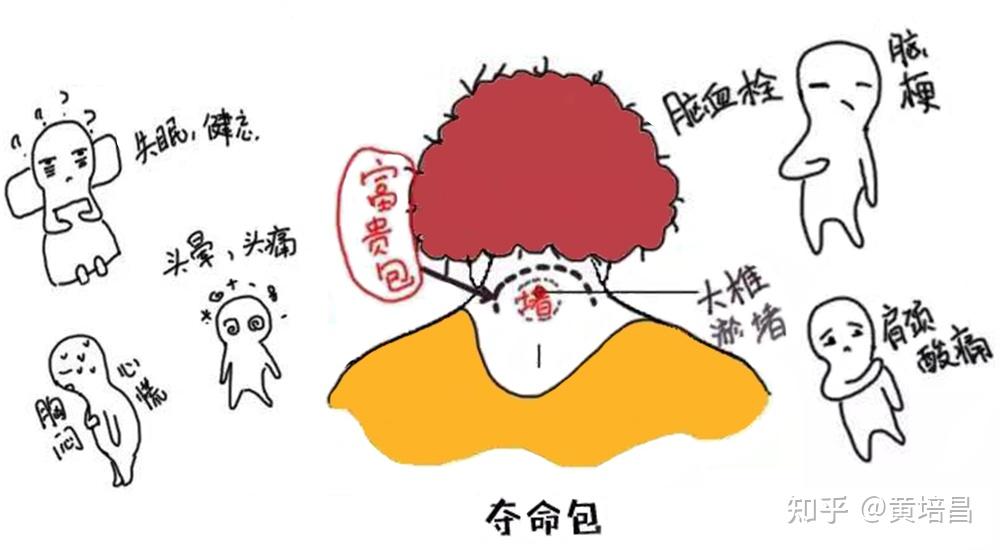 一,身材窈窕的人几乎是不长富贵包的,所以消除富贵