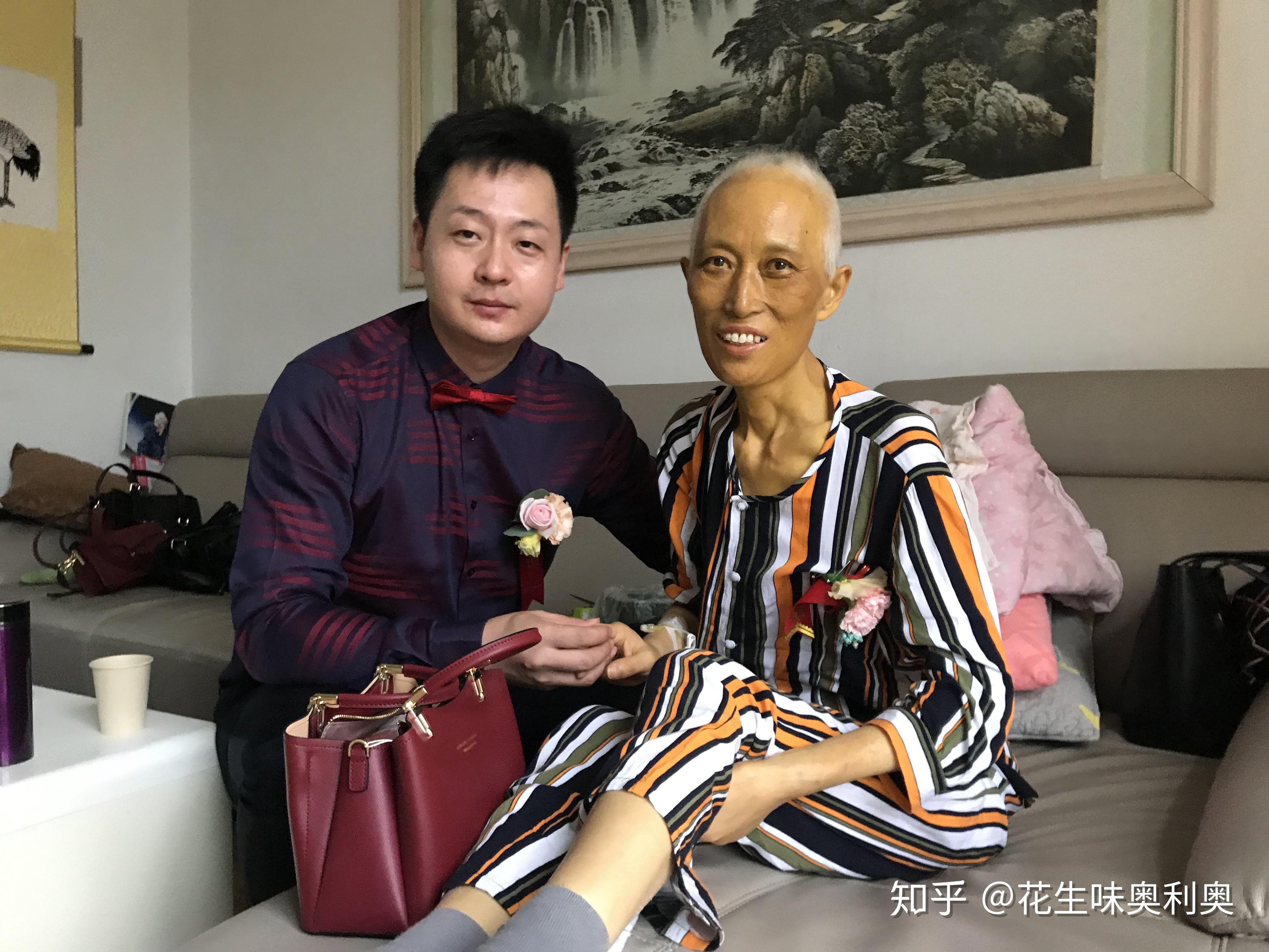 你知道的胰腺癌患者都活了多久? - 知乎