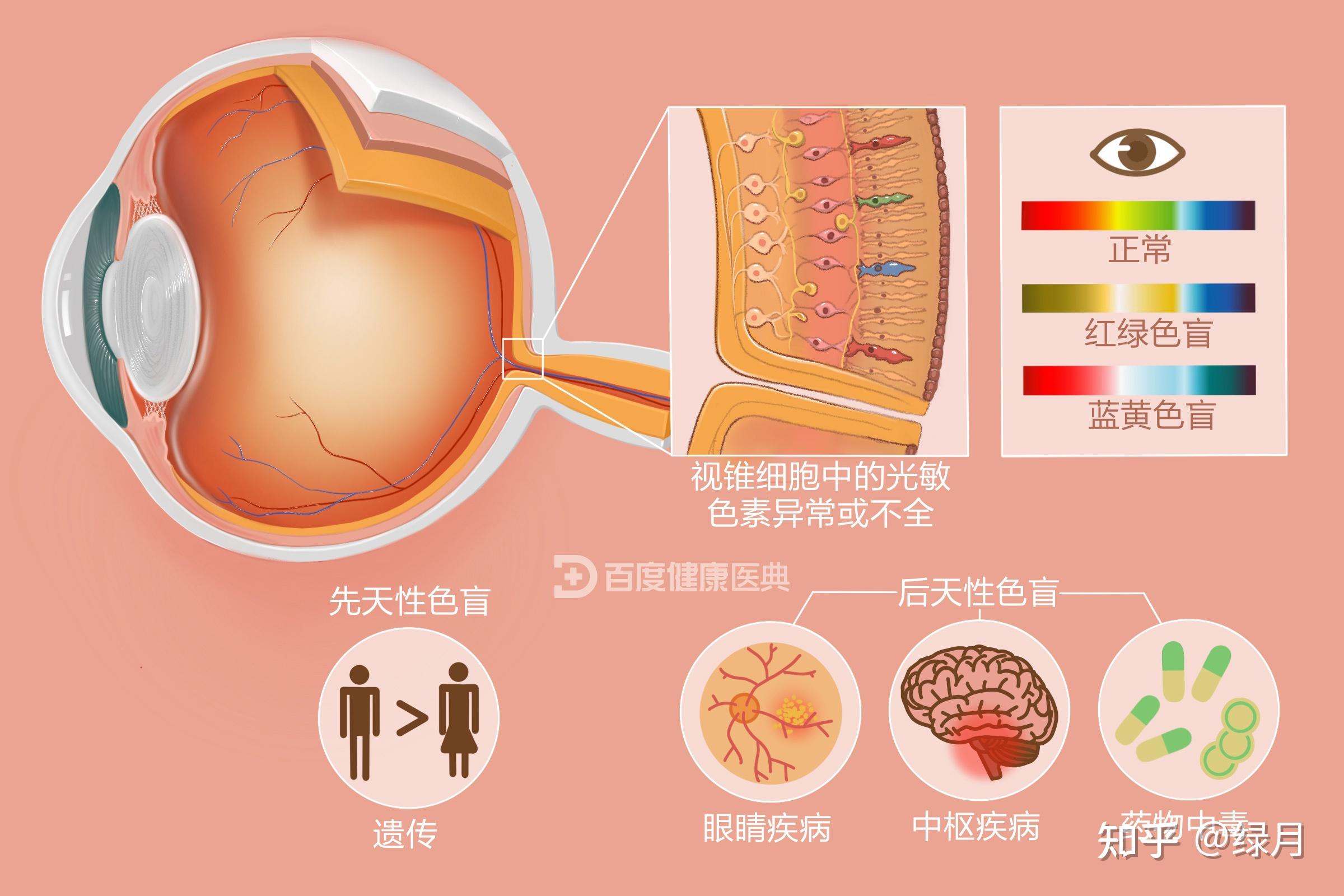 怎么区分一个人是蓝紫色弱还是单纯把蓝色叫做紫色? - 知乎