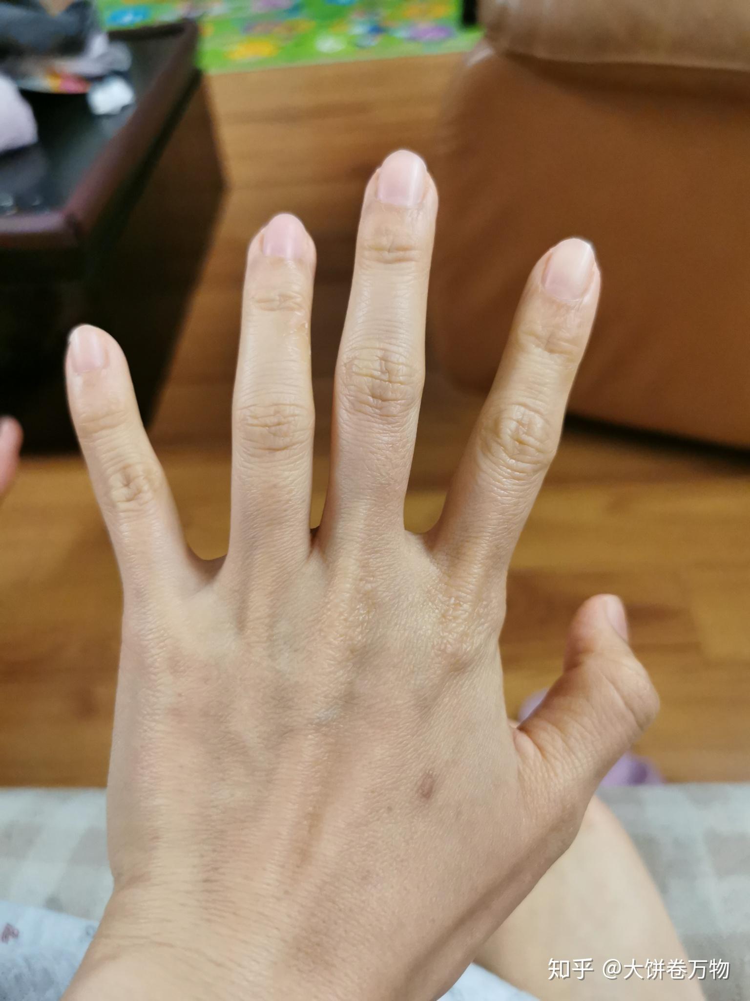 外科医生的手都是什么样的? - 知乎