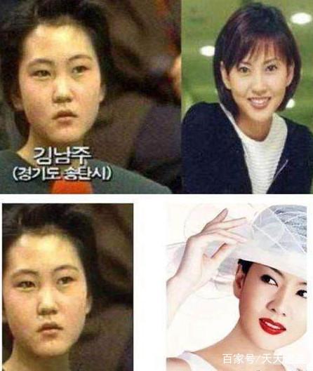 为何韩国人那么喜欢整容 知乎