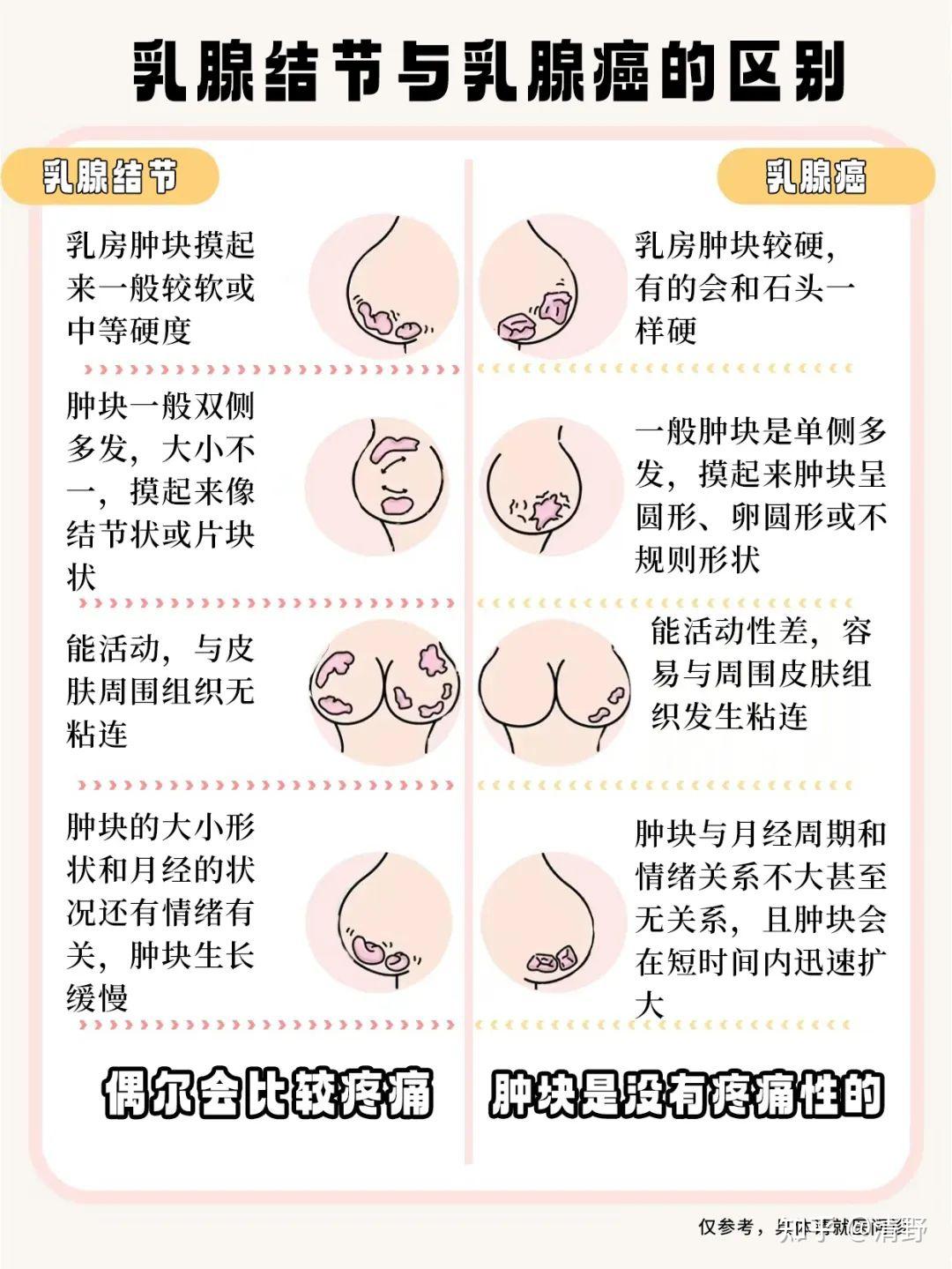 乳腺腺体硬图片