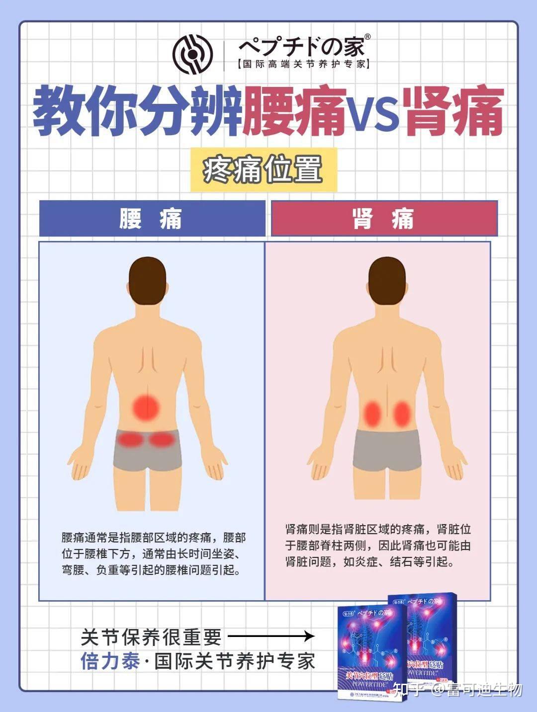 肾会痛吗图片