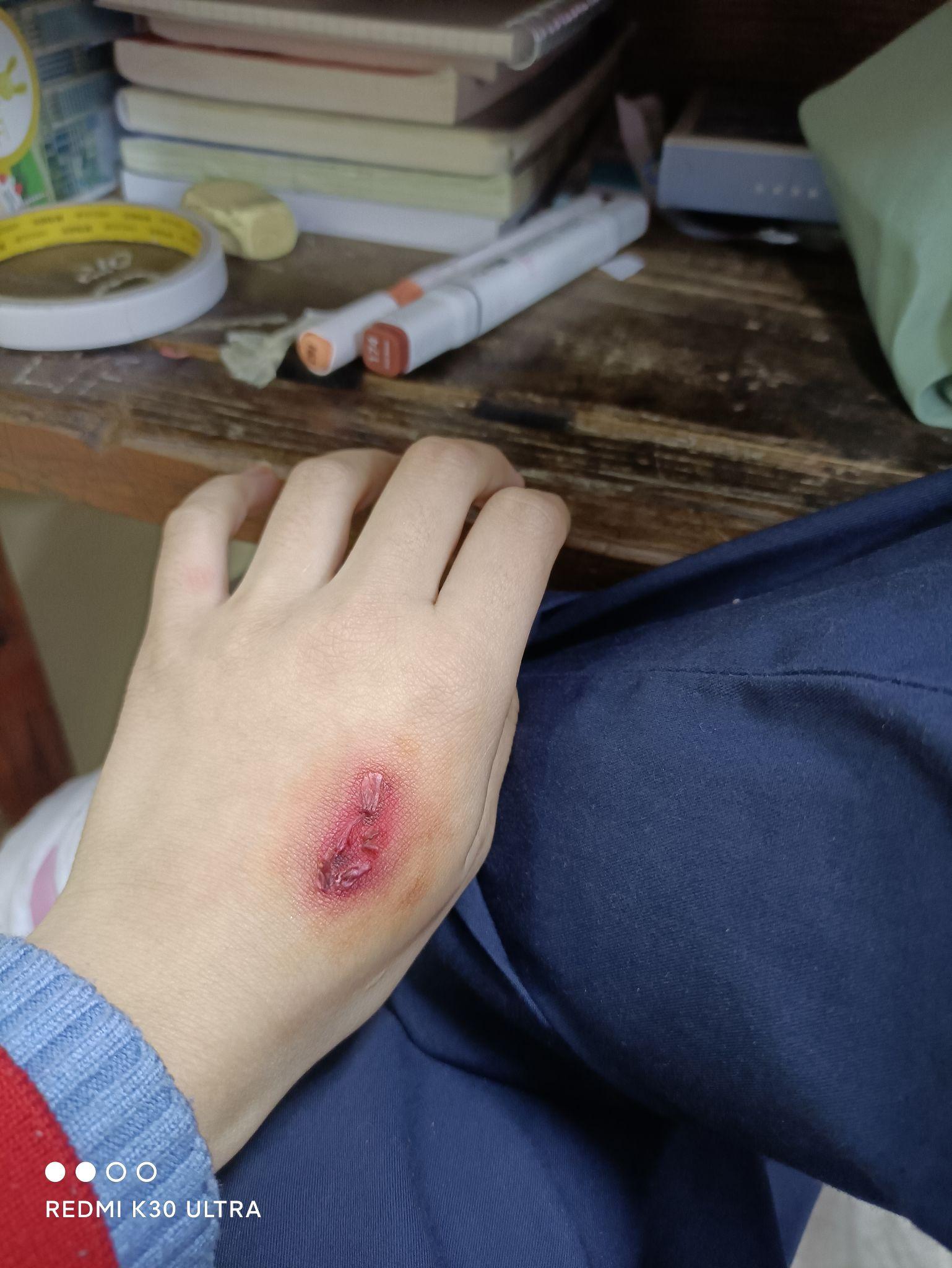 如何画出比较逼真的伤口