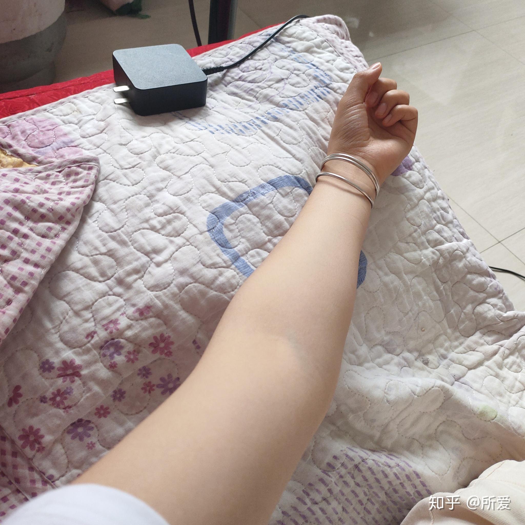 我这个肘外翻可以过兵检吗? - 知乎