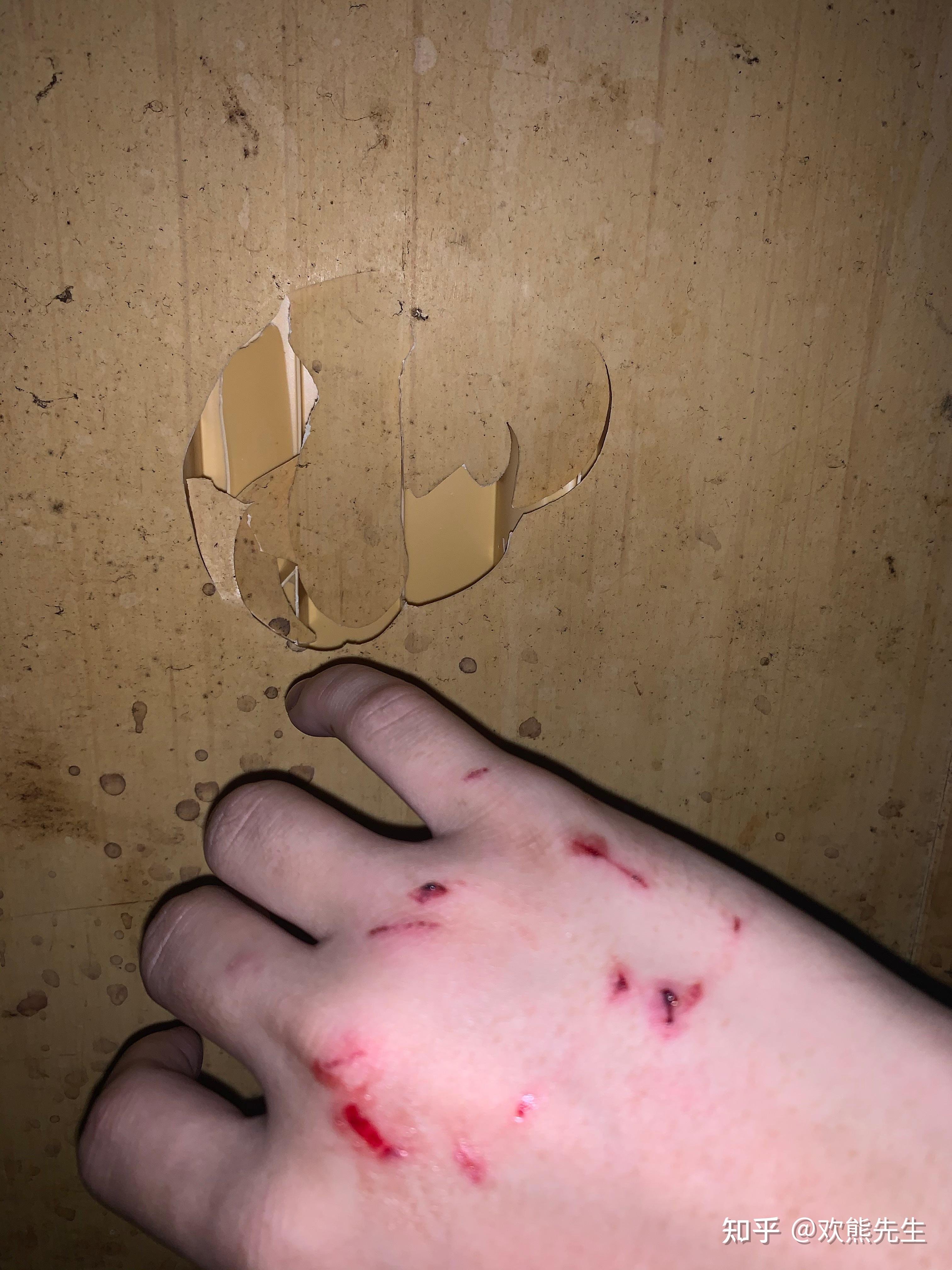 一拳打碎玻璃真的会受伤很严重吗