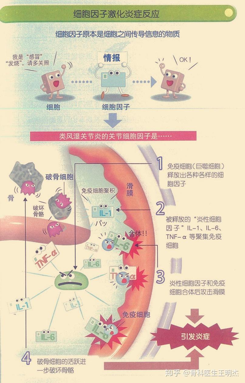 类风湿性关节炎机制图片