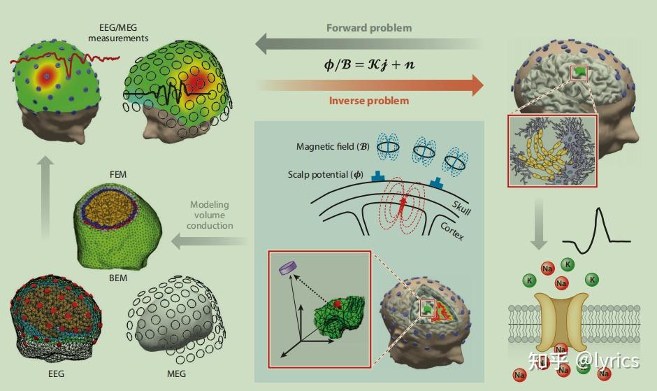 Electrophysiological Source Imaging: A Noninvasive Window to Brain ...