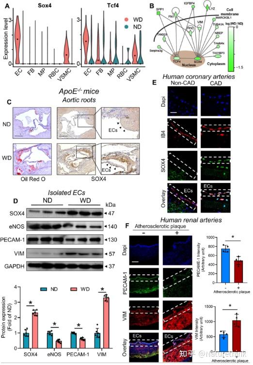 SOX4是单细胞分析揭示的动脉粥样硬化内皮细胞的新型表型调节因子 - 知乎