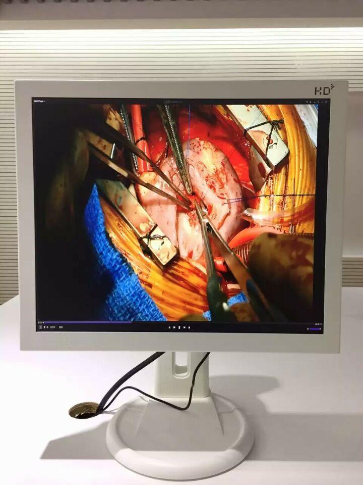 利豪捷:15寸手术室医疗显示器