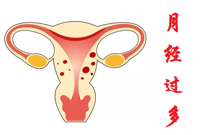 v2-1872399ddd908343594f554dab18c5ad_1440w.jpg?source=172ae18b