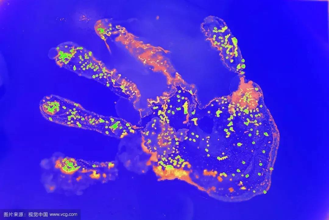 女性手上的细菌比男性多?我不理解 - 知乎