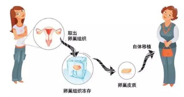 什么是骨髓移植 v2-18a3e176c13b2e44e6e88605d93207d7_1440w.jpg?source=172ae18b