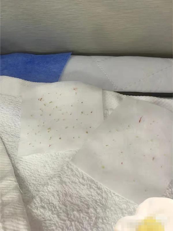 为什么做针清一定要到专业皮肤医院？ - 知乎