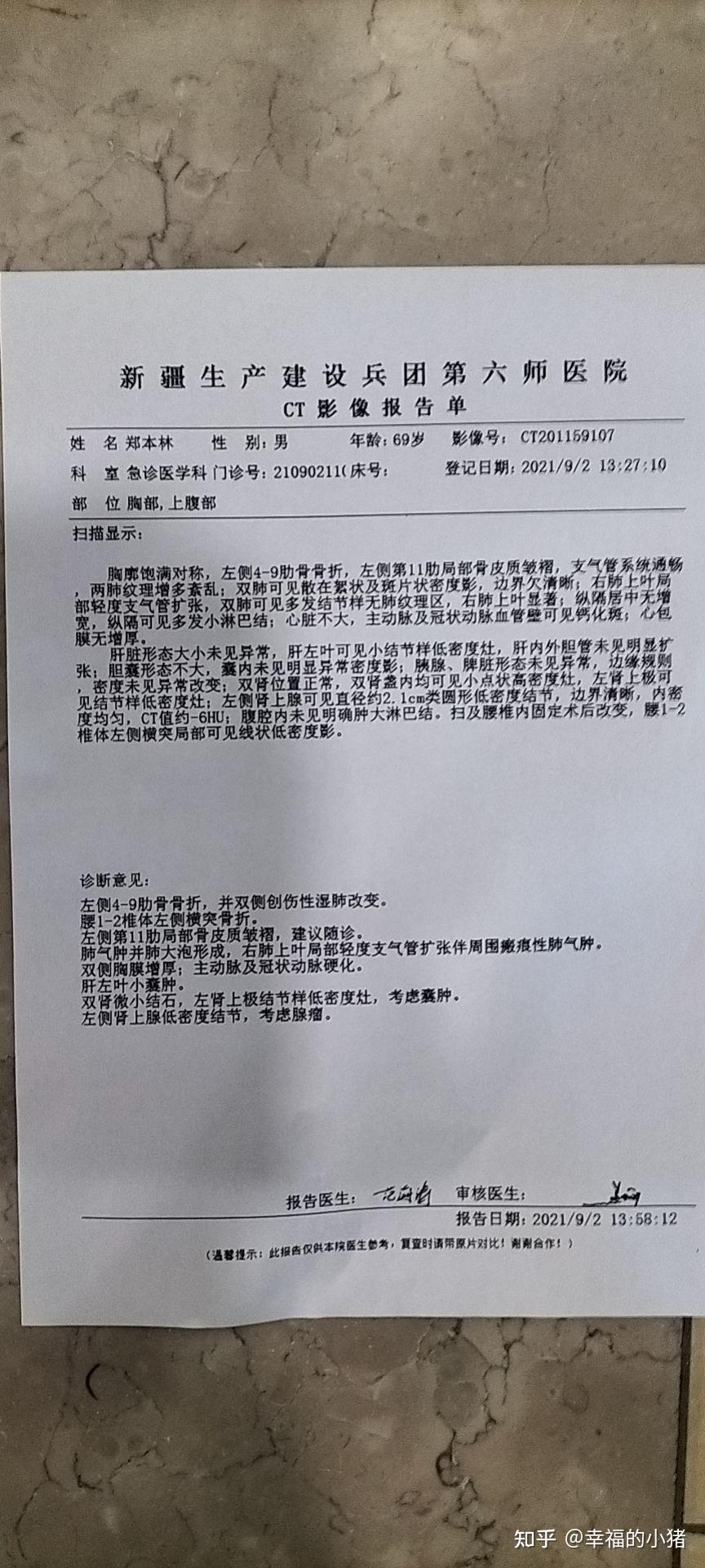 车祸一根肋骨骨折赔偿多少? - 知乎